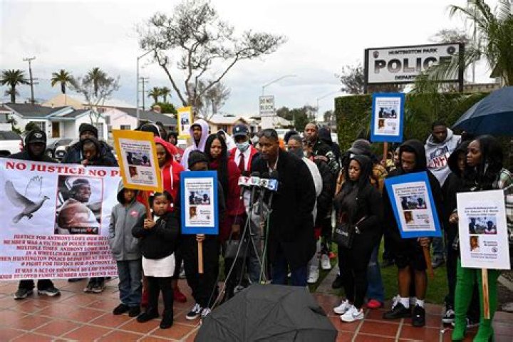 
California Police Fatally Shoot Double Amputee Stabbing Suspect as He Tried to Flee 