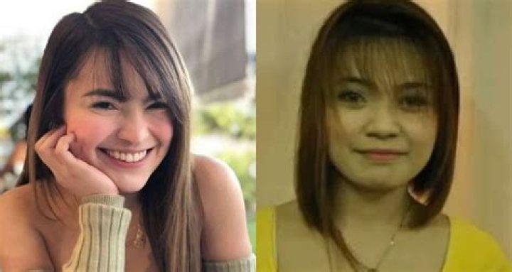 
Lai Austria Before Surgery Pics, Is She Transgender? Boyfriend And Net Worth 