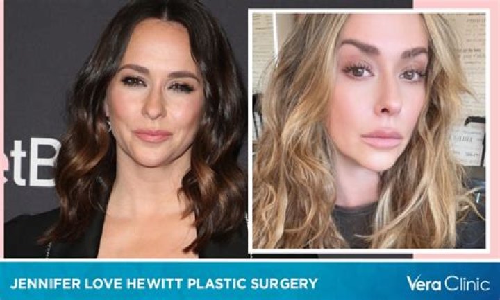 Why Jennifer Love Hewitt looks different: Did actress undergo plastic surgery?